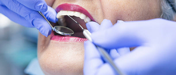 Best After-Hours Emergency Dentist in Capitol Heights, MD
